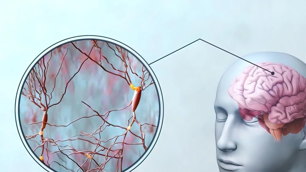pros and cons of tms therapy​ 